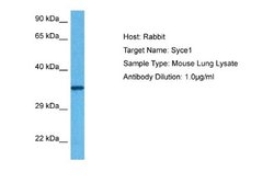 SYCE1 Rabbit anti-Mouse, Polyclonal, Novus Biologicals 0.1ml; Unconjugated:Antibodies,